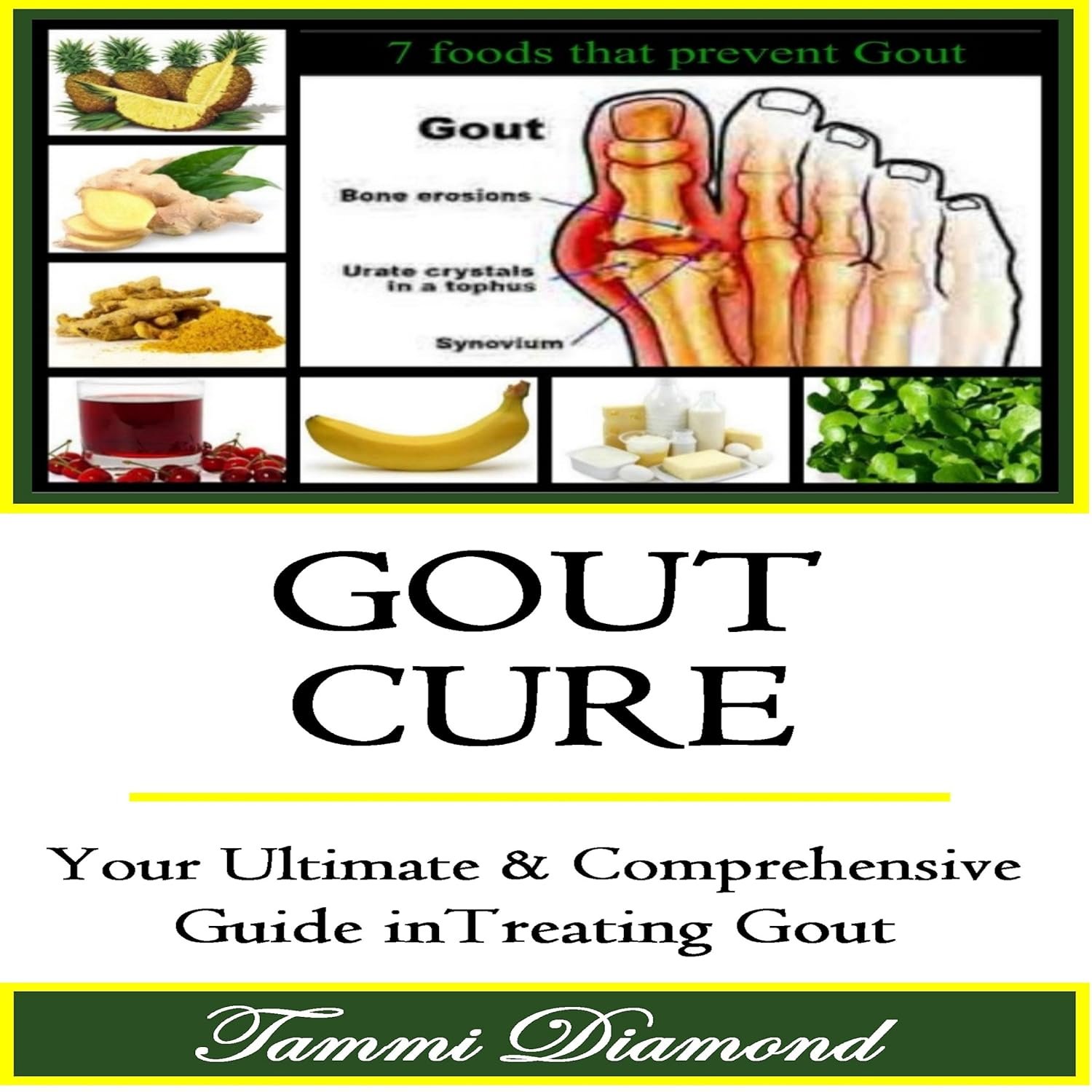 Gout Cure: Your Ultimate and Comprehensive Guide in Treating Gout                                                                      Audible Audiobook                                     – Unabridged