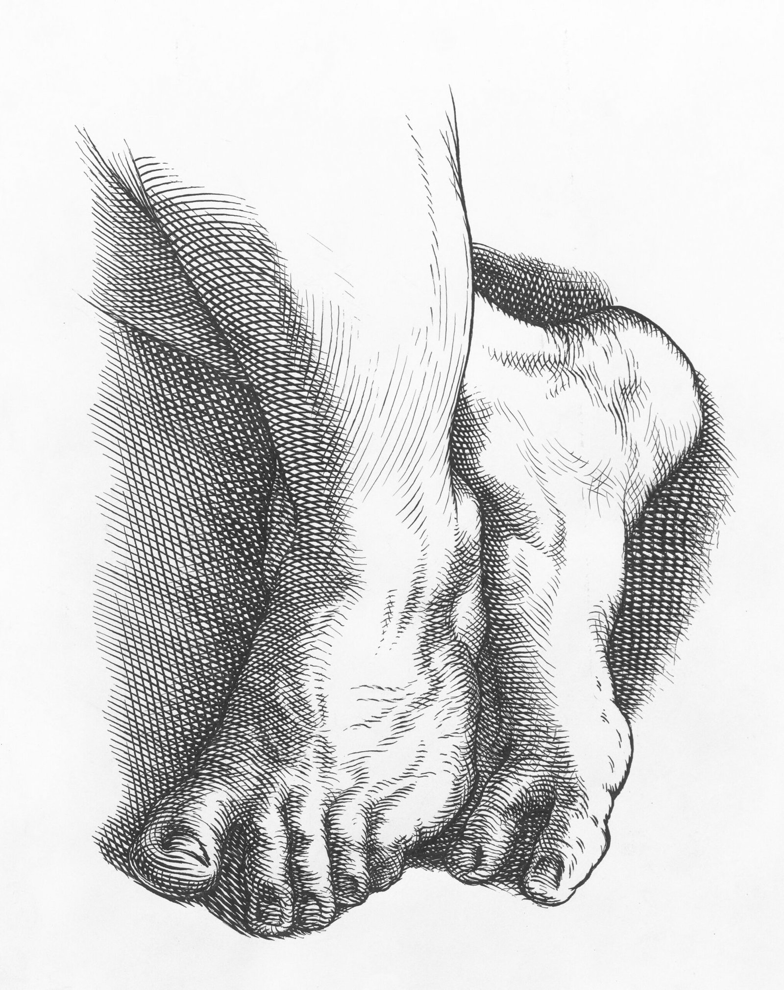 How Do You Test For Gout And Pseudogout?