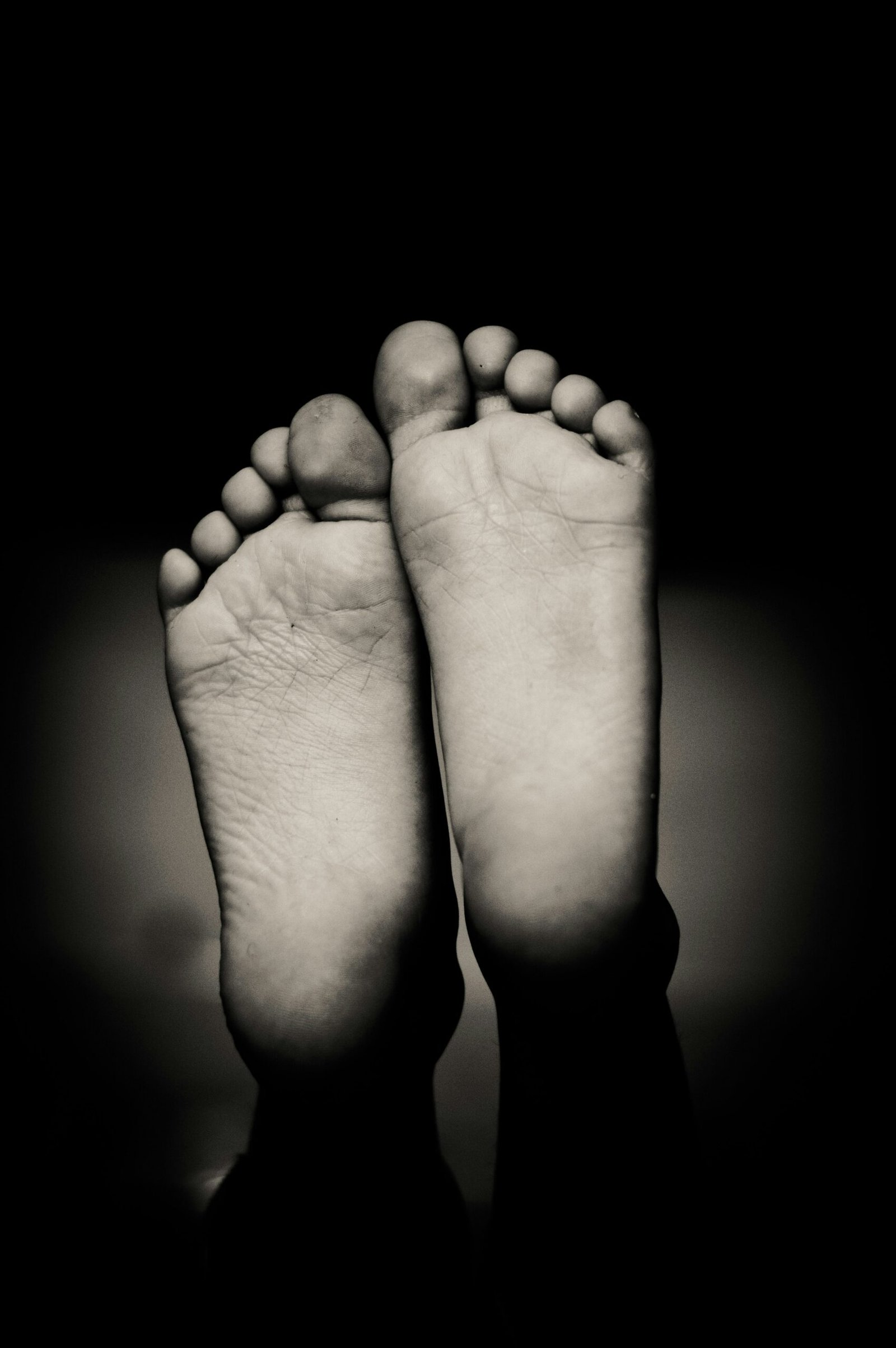 Why Am I Having Multiple Gout Attacks?