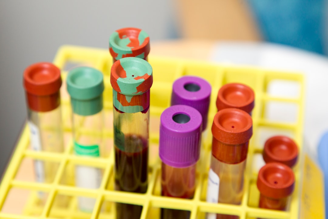 Blood sample tubes in a clinical laboratory representing uric acid blood testing.